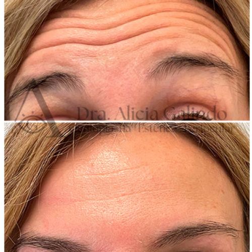 Medicina estética facial